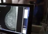 Estudo propõe alternativa de mamografia sem compressão durante exame