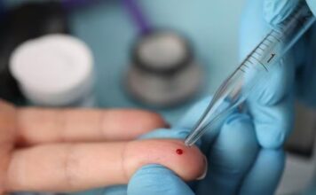 Mais de 60 testes reforçam busca ativa contra tuberculose e ISTs em Boiçucanga