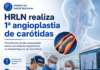 Hospital Regional do Litoral Norte realiza 1ª angioplastia de carótidas e amplia atendimento de alta complexidade